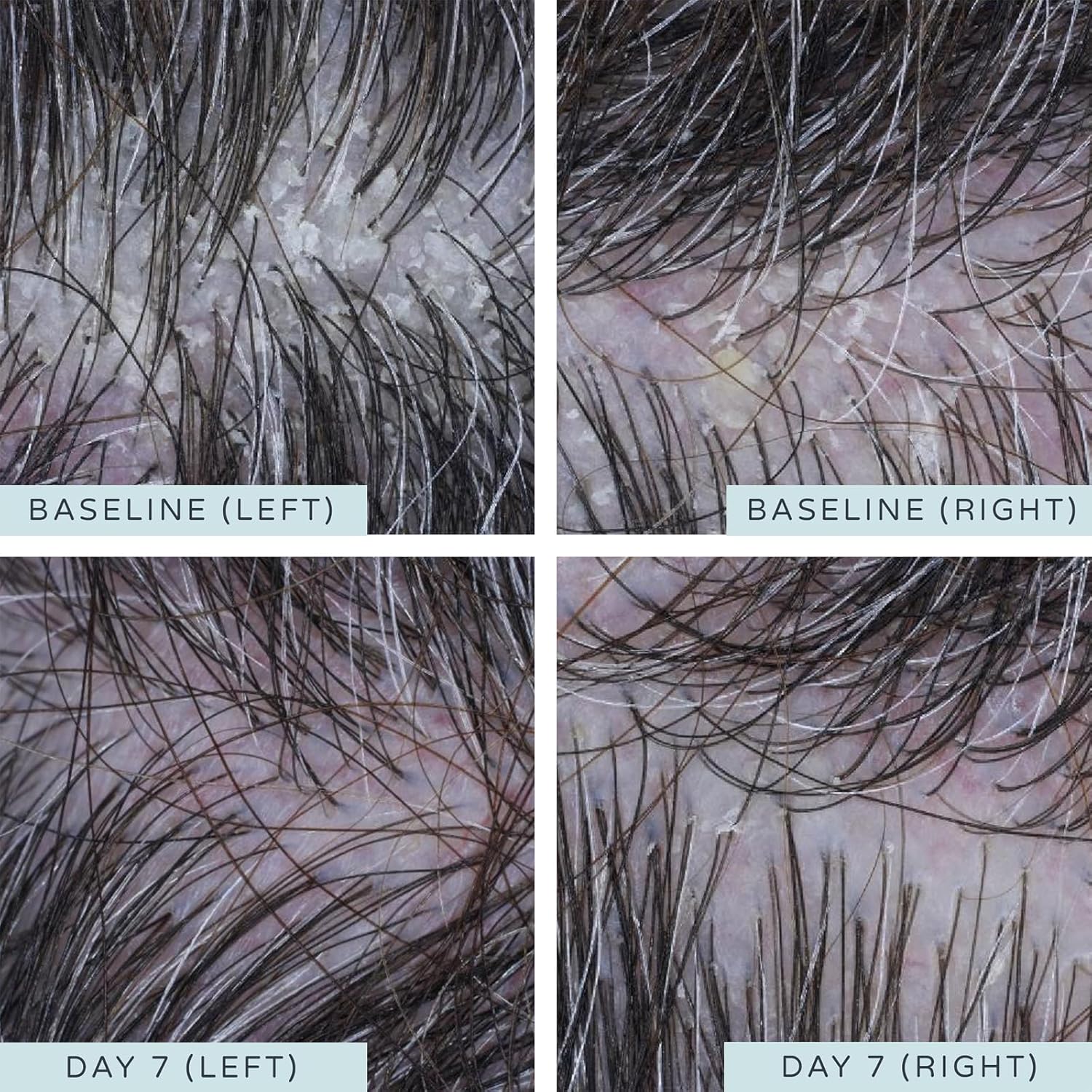 AMELIORATE Clarifying Scalp Exfoliant - 90ml - Image 3