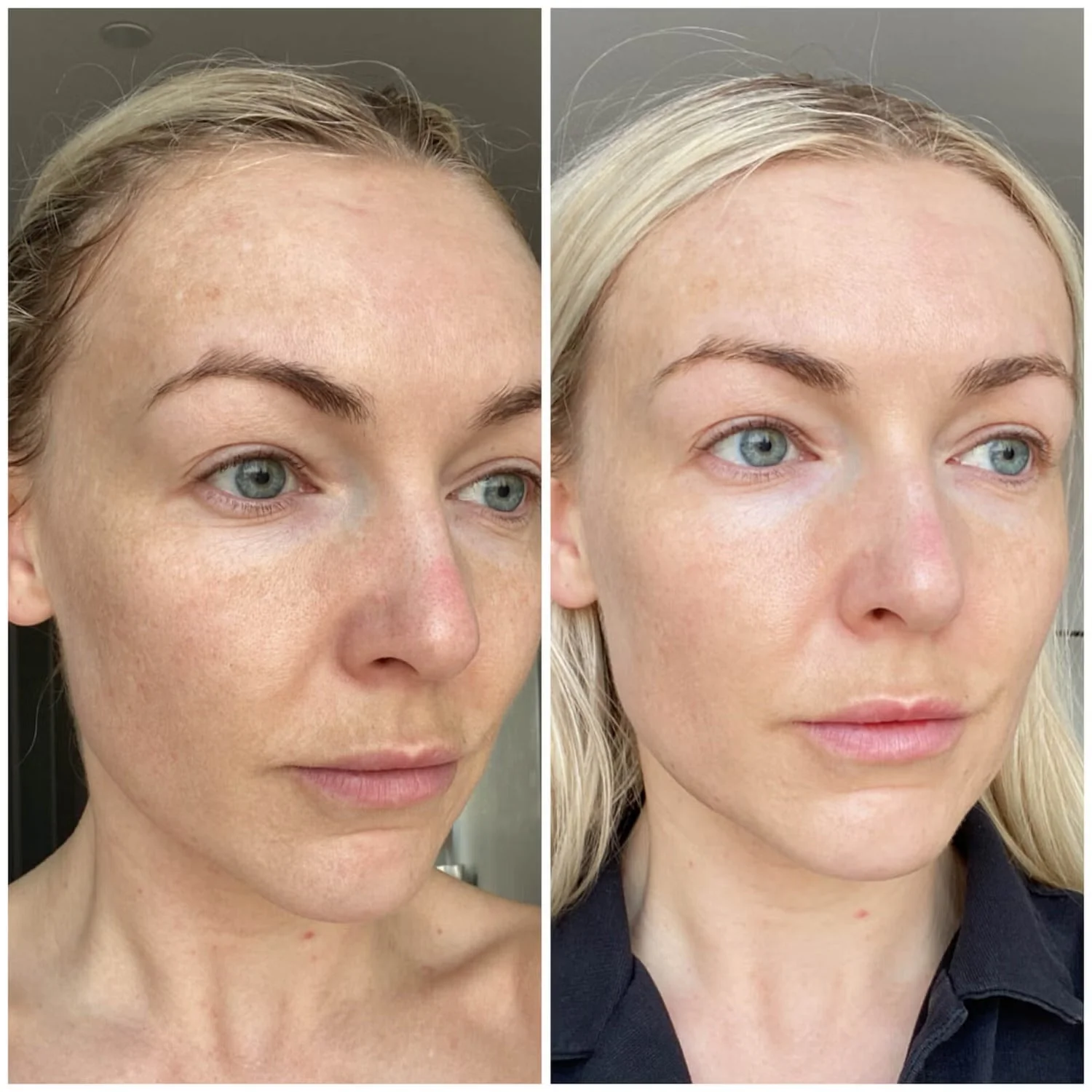 AMELIORATE Resurfacing Facial Toner - 200ml - Image 2