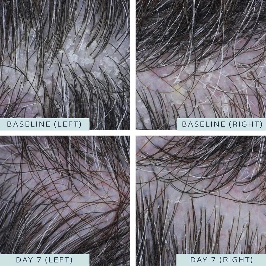 AMELIORATE Soothing Scalp Essence - 3x50ml - Image 4
