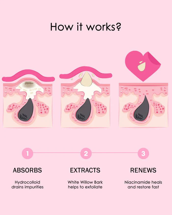 CHOK BEAUTY Acne Patches - Duo Pack (60 Patches) - Image 3