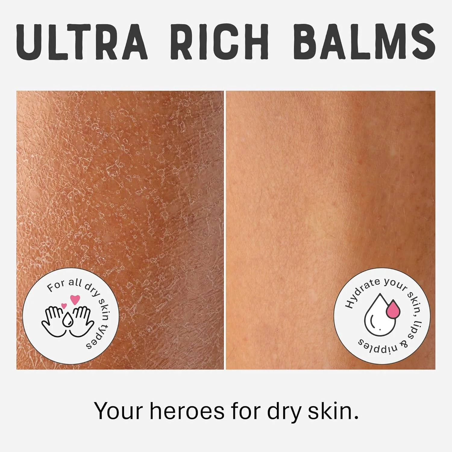 Dr. Lipp Dry Skin Heroes 30ml + 8ml - Face, Hand, Foot & Body Butter - Image 5