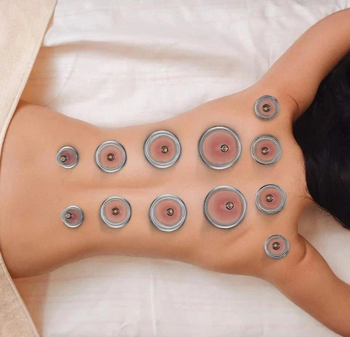 Purava Premium 12pc Cupping Therapy Set With Vacuum Pump - Image 2