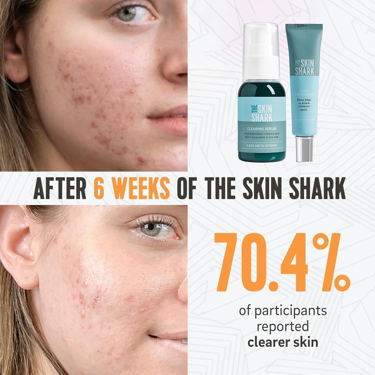 The Skin Shark Breakout Clearing Serum - (50ml) - Image 2